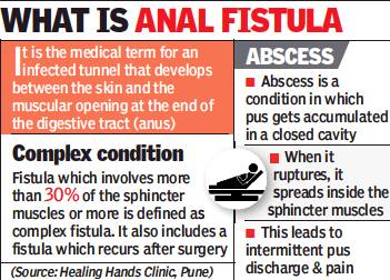 What is anal fistula