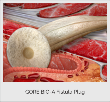 Fistula plug for fistula