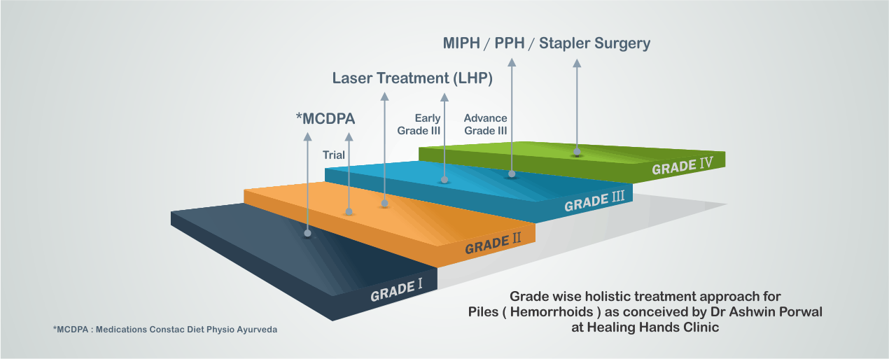 Grade and stages of piles