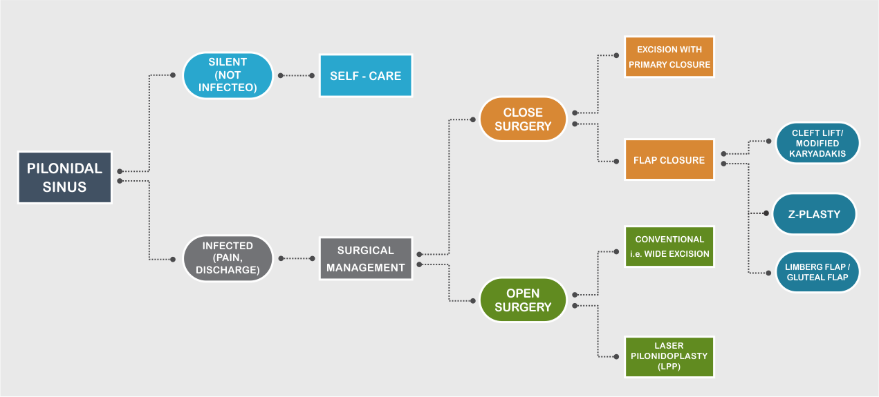 Treatment of pilonidal sinus