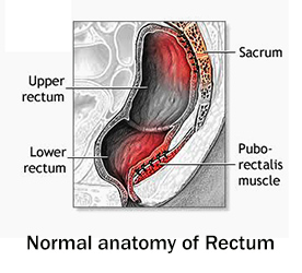 Symptoms and causes of Rectal Prolapse